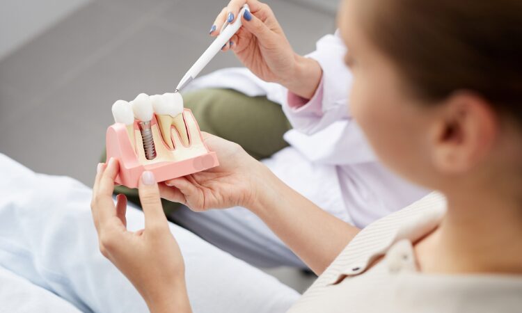 The dental implant process involves several critical steps. Each step is essential for the success and longevity of the implant.